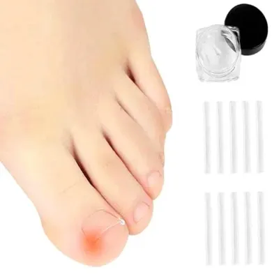 발톱관리세트 내향성발톱교정 발톱케어용품 10p