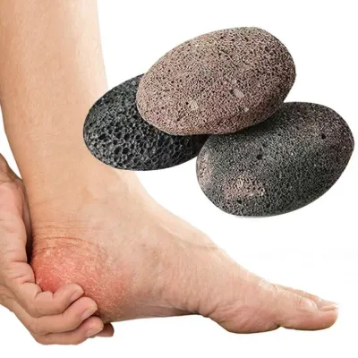 발뒤꿈치 각질제거 돌 화산석 발굳은살 바닥 발뒷꿈치 관리