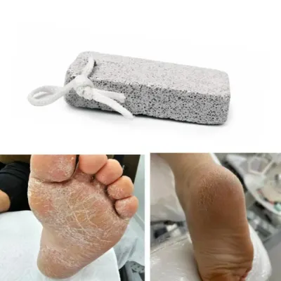 돌 각질제거 발뒤꿈치 풋케어 복숭아뼈 팔꿈치 무릎 굳은살 뒷꿈치