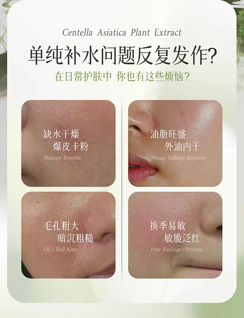 적설초 맑은 맑은 마스크 수분 케어 밸런스 수분 오일 산뜻하고 보습 밤샘 수분 케어 상세5