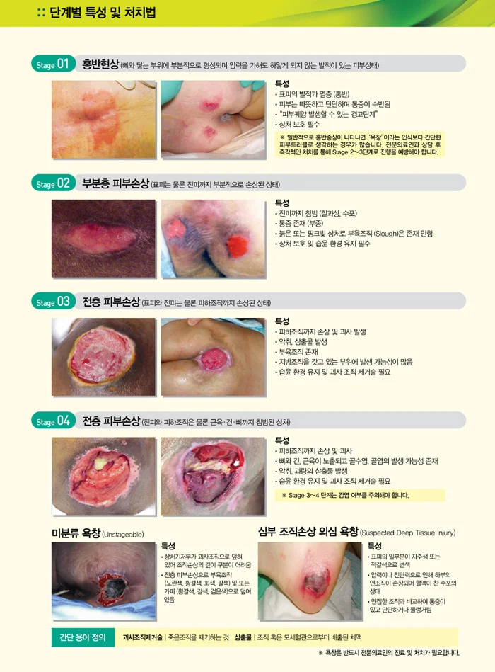 ConvaTec 칼토스타트 5X5cm 10장 알지네이트 드레싱 상세3