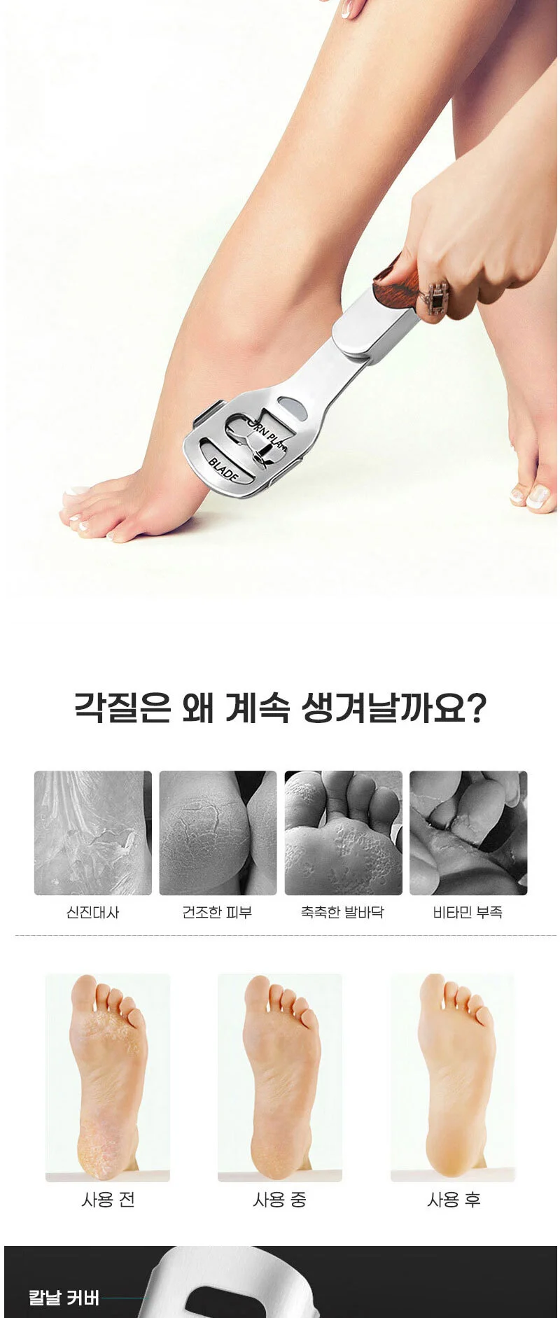 발각질 콘커터 헤드 교체칼날 상세3