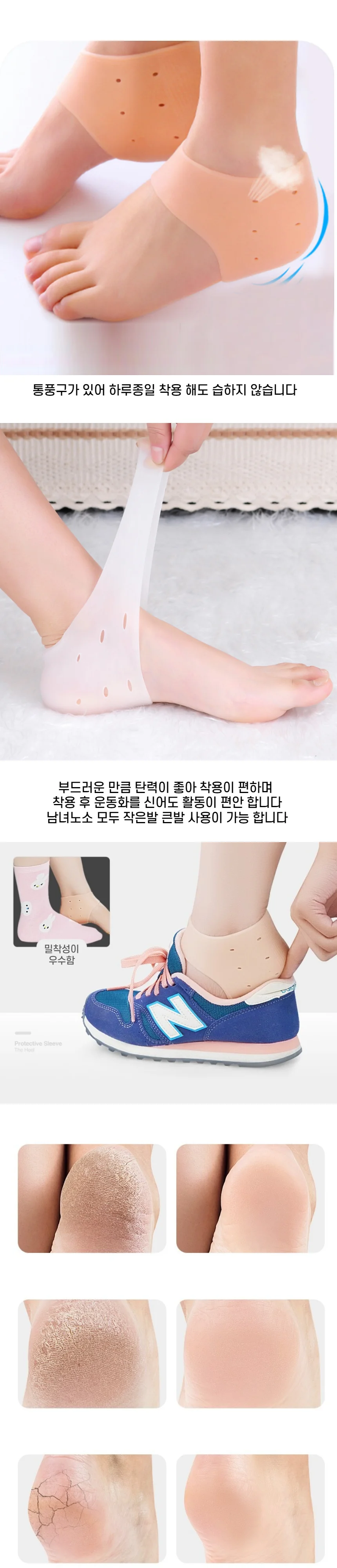 각질패드 발뒤꿈치통증 완화 뒷꿈치패드 상세2