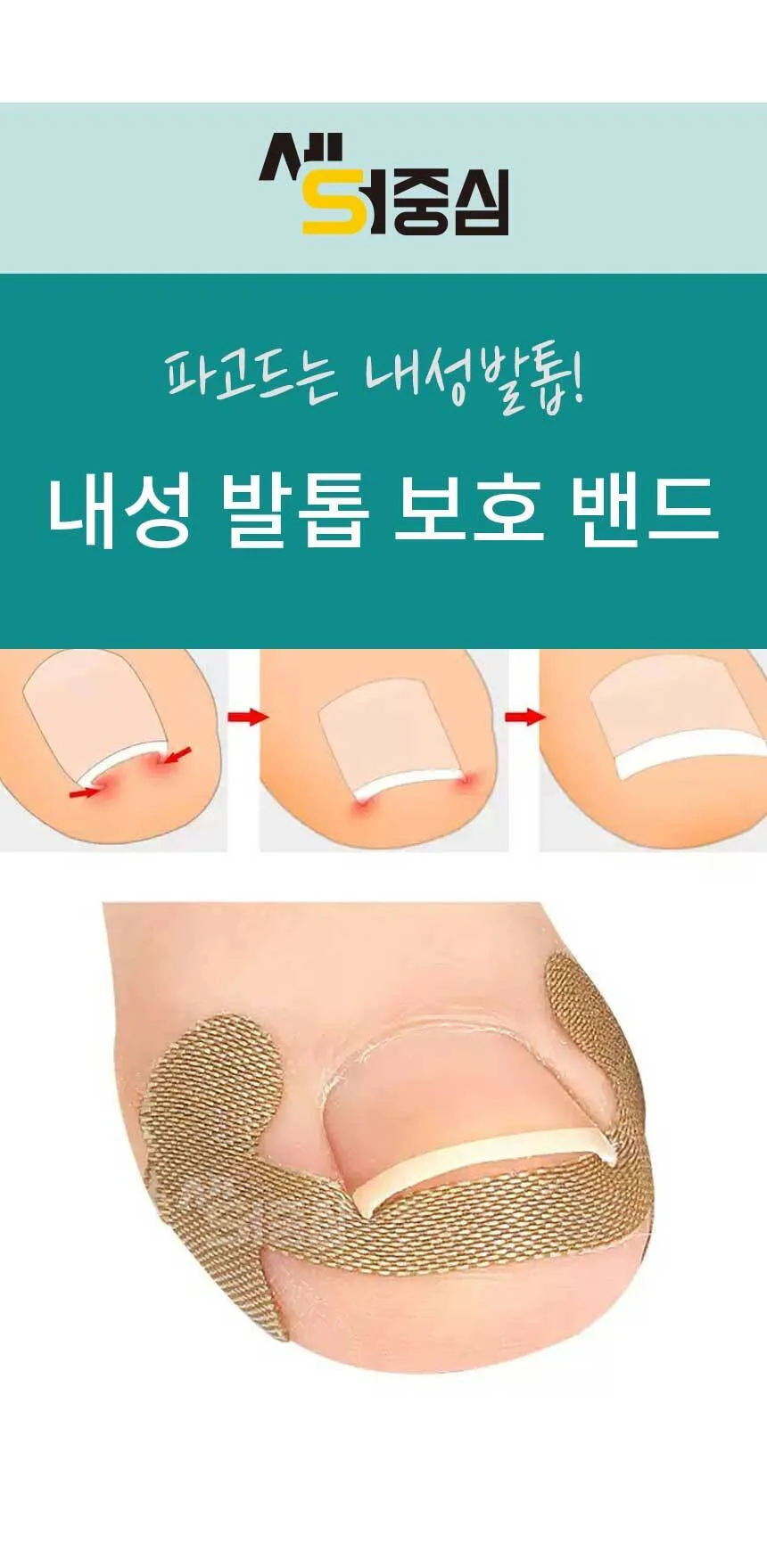 내성발톱 스티커 발톱케어 보호 밴드 발톱관리 페디밴드 40개 AG 상세1