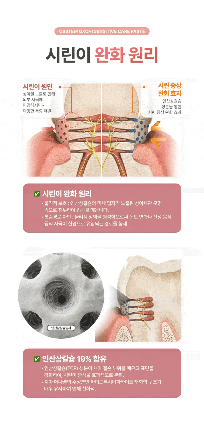 (오스템) 옥치 시린이 치약 150g 후레쉬민트향 (60개입) 상세3