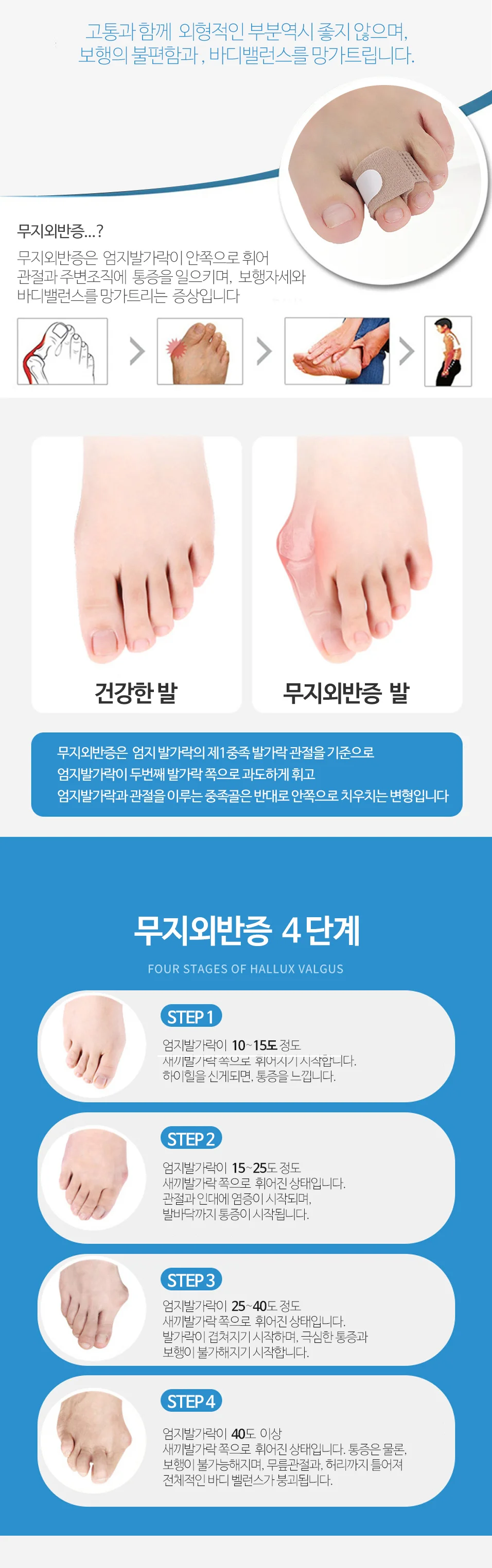OC1069 힘차지 벨크로 손가락 발가락 교정 분리 밴드 상세4