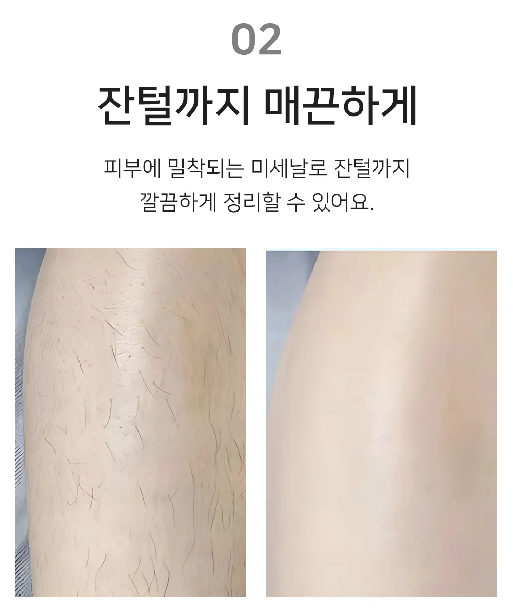셀링온 제모기 상세4