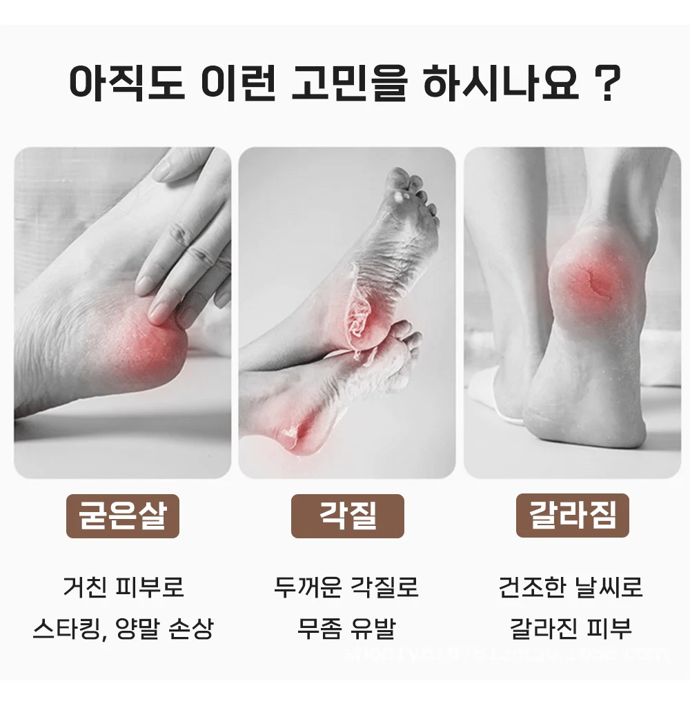 혀니추천 발각질제거기 발뒷꿈치각질제거 상세4