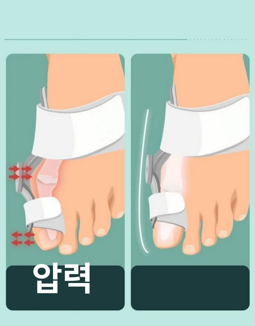 무지외반증교정기 엄지발가락보호대 발가락부목 교정 상세5