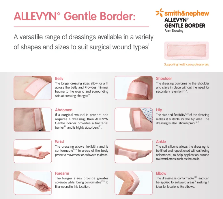 S N 알레빈 ALLEVYN Gentle Border Lite 10X10cm 10개입 상세1