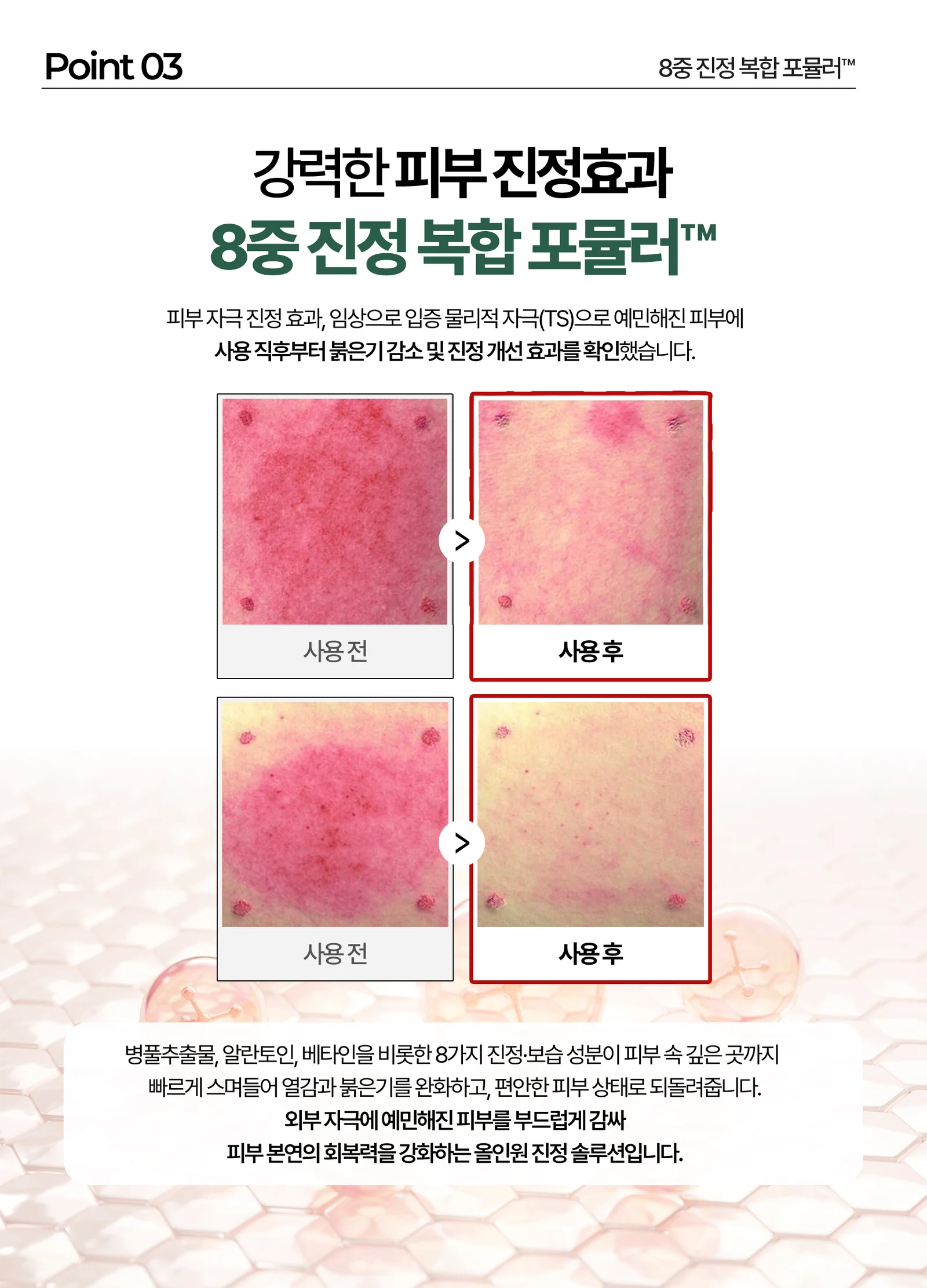 루미나D 피부보습크림 메디케어플러스 건조 피부 얼굴 바디 보습용 상세7