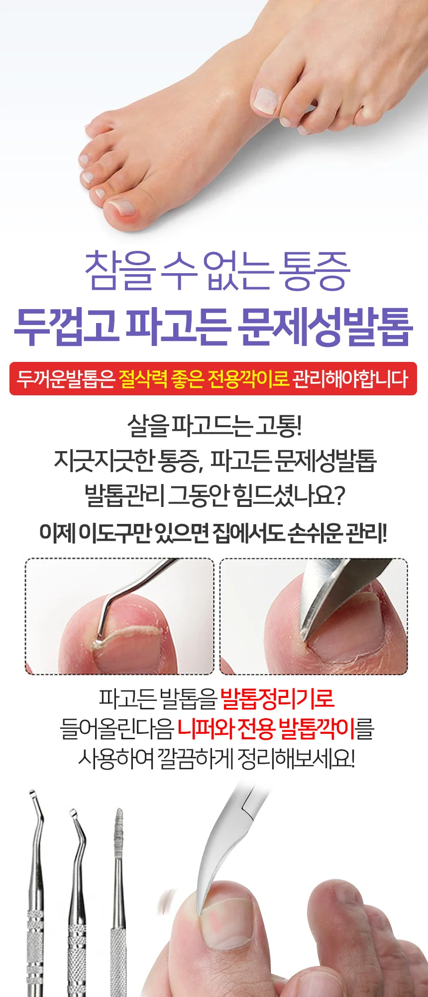 발톱 두꺼운 문제성발톱 무좀 발톱 니퍼 상세1