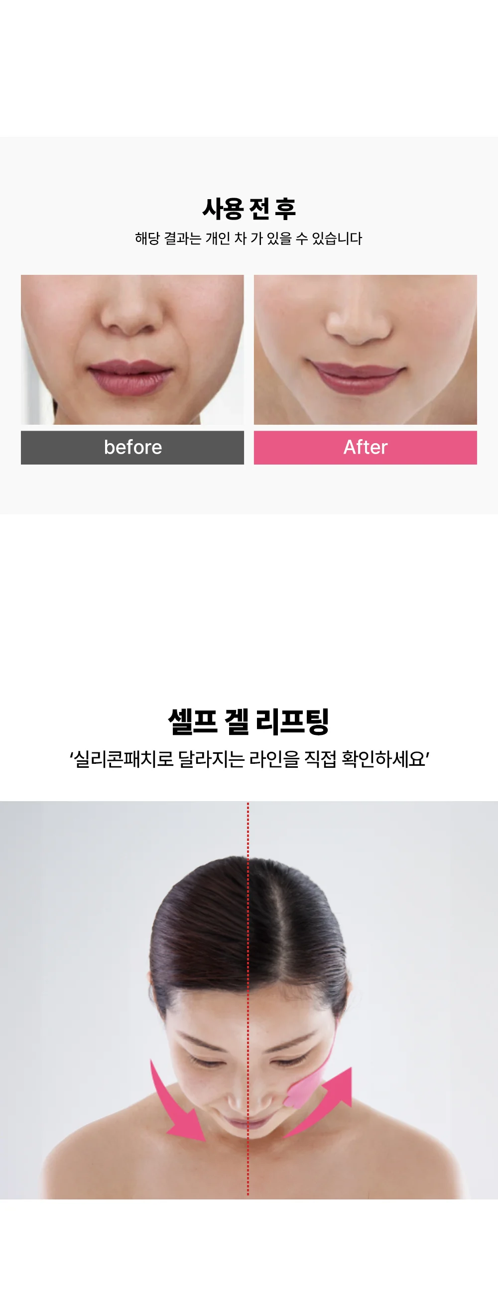 페이스리프팅 치크 겔패치 101312 상세4