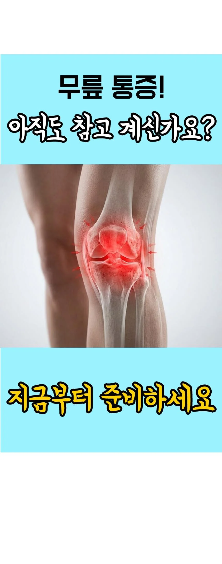 무릎 슬개골 슬개건 보호 실리콘 무릎보호대-02 HT 상세2