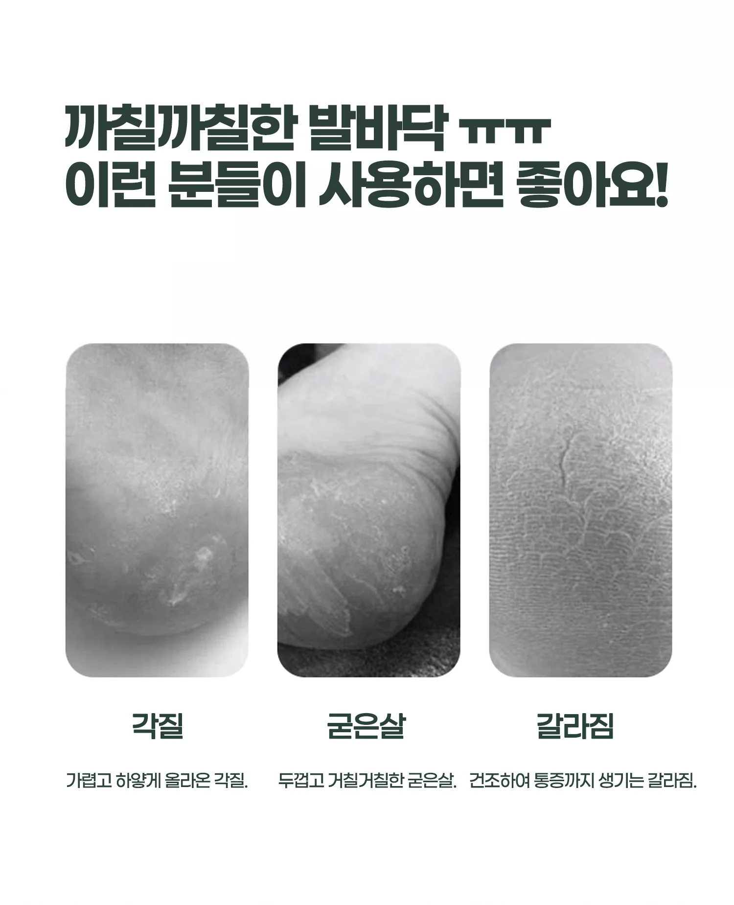 각질제거기 발뒤꿈치각질 굳은살제거 발뒤꿈치관리 상세2