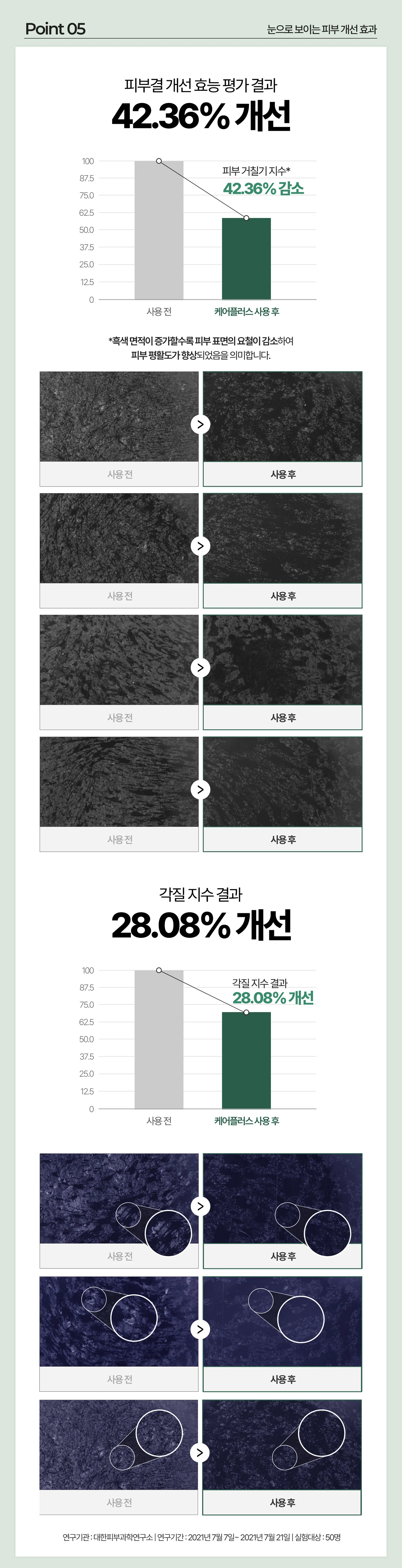 루미나D 피부보습크림 메디케어플러스 건조 피부 얼굴 바디 보습용 상세9