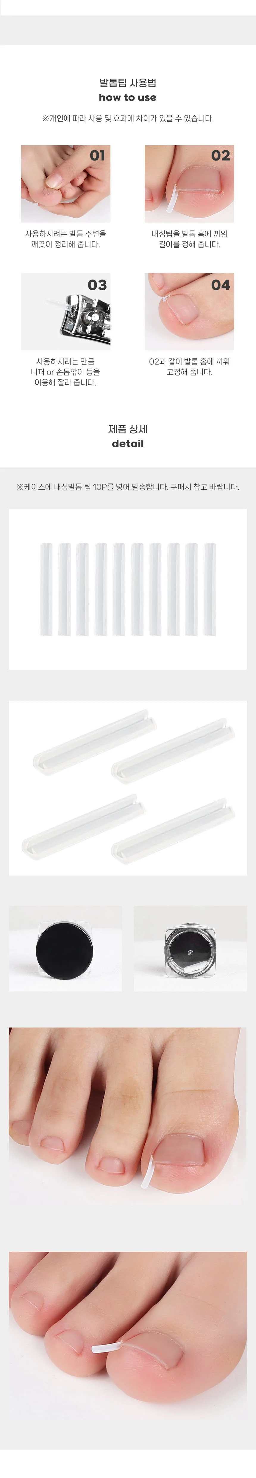 내향성 내성발톱 교정 밴드 발가락 보호 와이어 10P 상세2