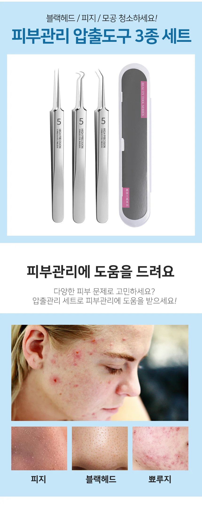 블랙헤드 압출기 세트 피지제거기 얼굴피지제거기 피지핀셋 상세2