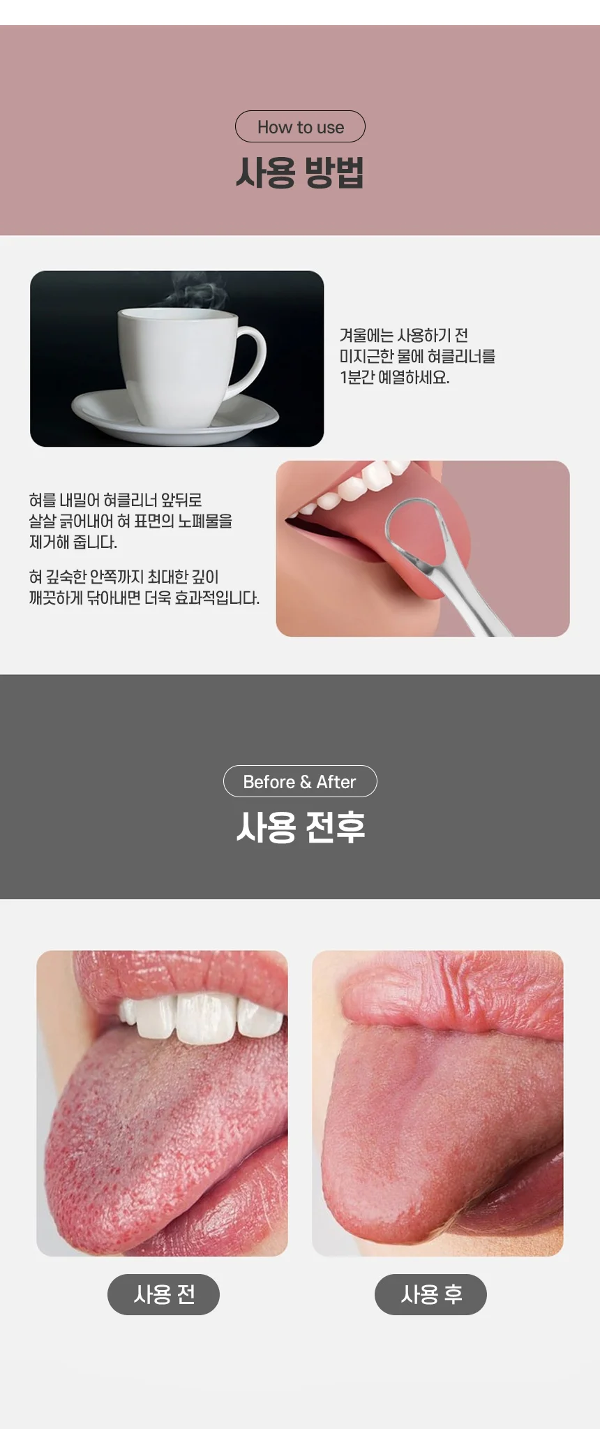 스텐 혀클리너 구강 위생 제거 백태 관리 용품 상세5