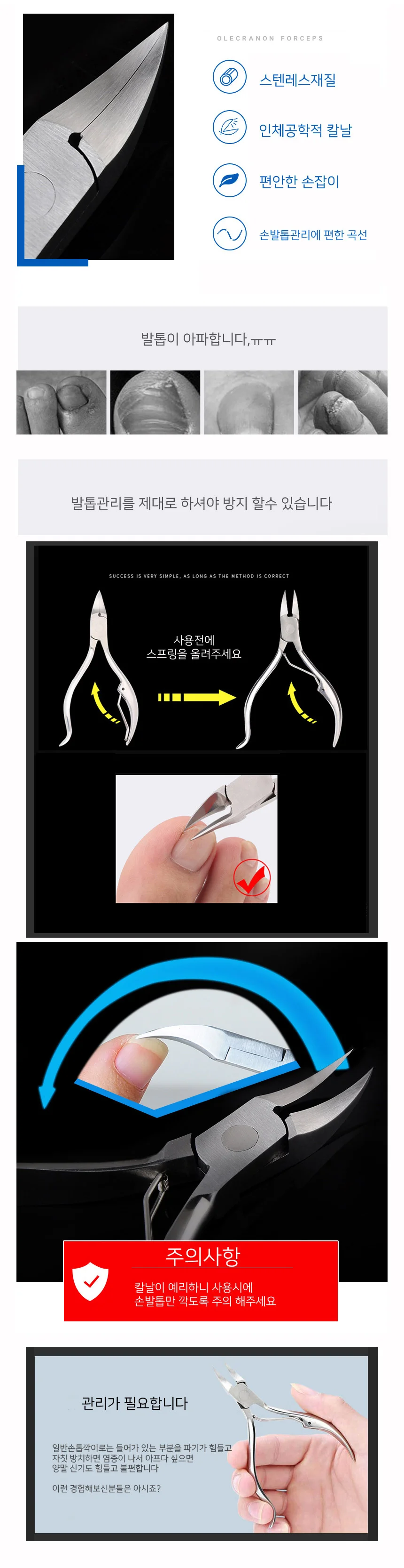 내성발톱깍기 손톱 발톱 깎이 니퍼 파고드는 내향성 상세3