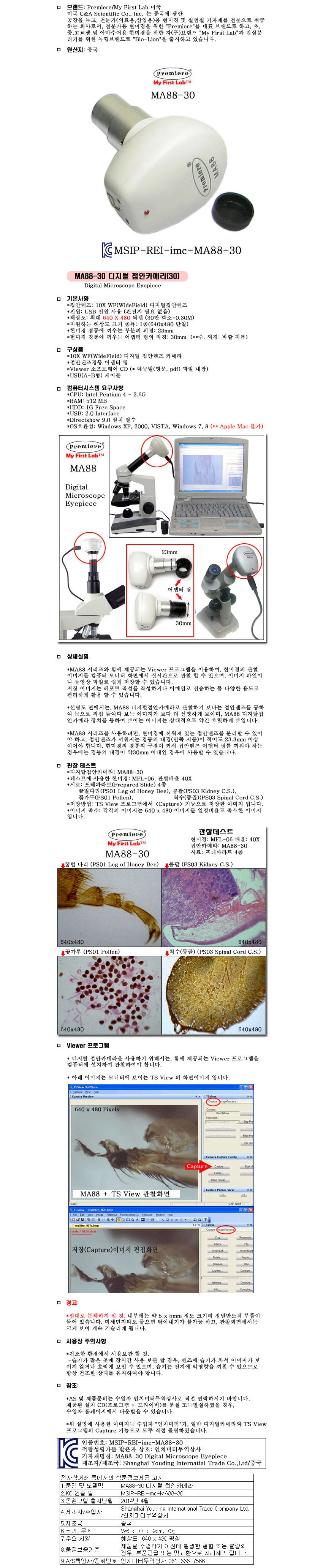 피부측정 확대경검사 디지털 접안카메라 30M 상세1
