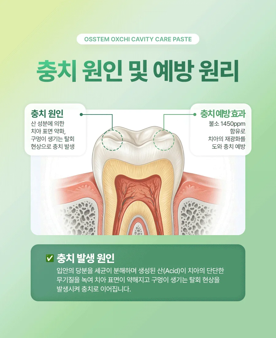 (오스템) 옥치 불소치약 150g 아쿠아민트 (60개입) 상세3