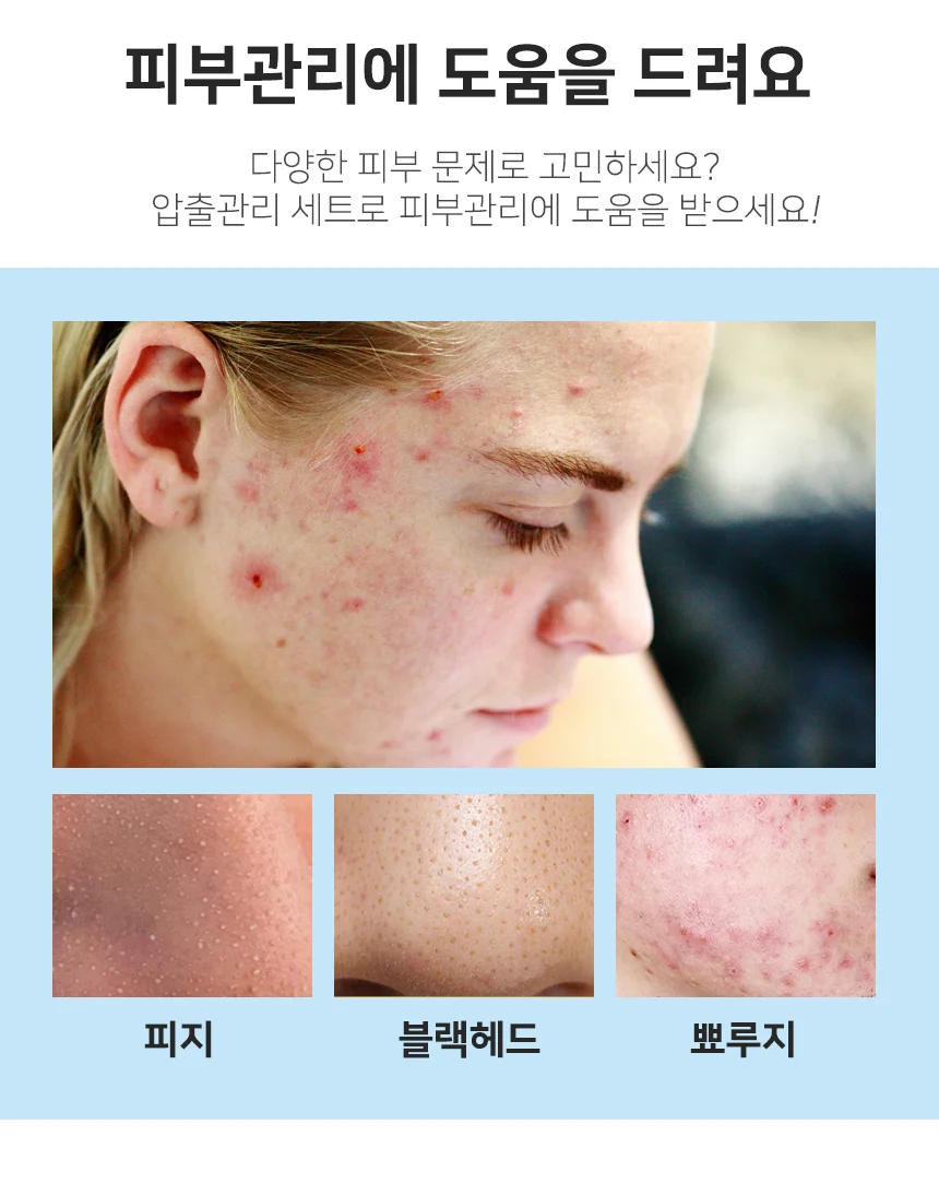블랙헤드 압출기 세트 피부관리용품 피부관리제품 압출도구 상세3